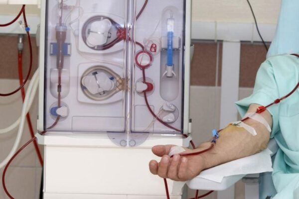 Dialysis Treatment