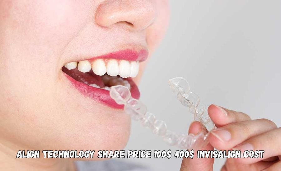 align technology share price 100$ 400$ invisalign cost